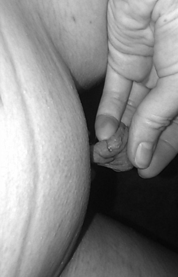 A woman showing the length of her lips while holding them in her hand.